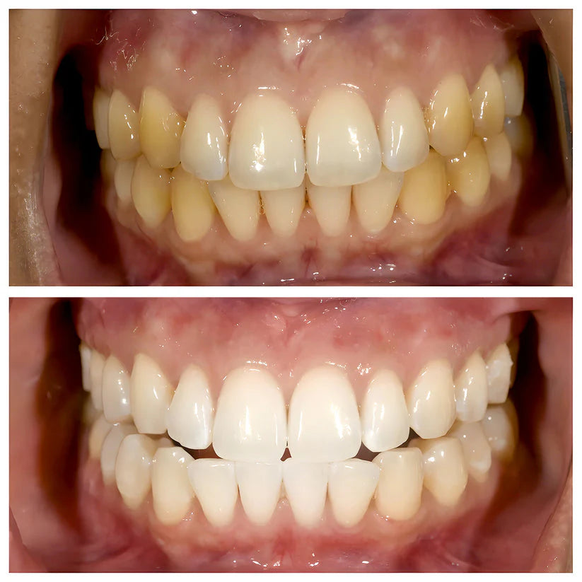 ORAH Teeth Whitening Powder